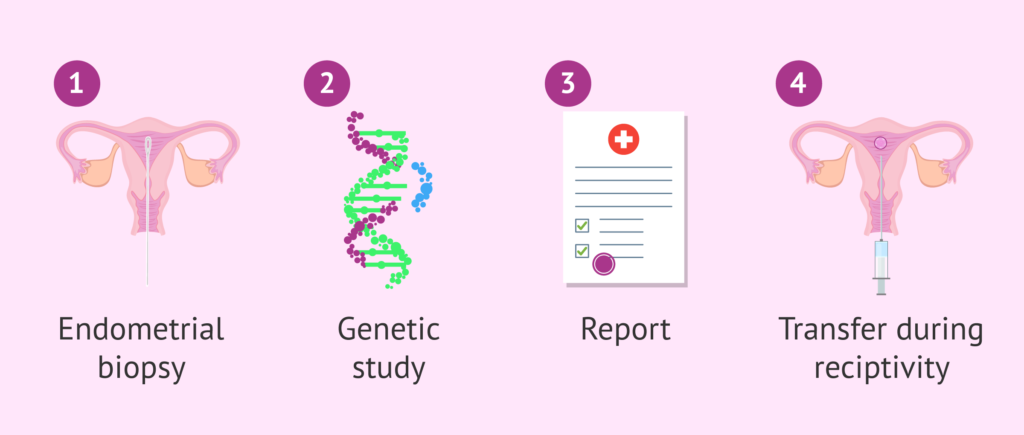 process-of-era-test